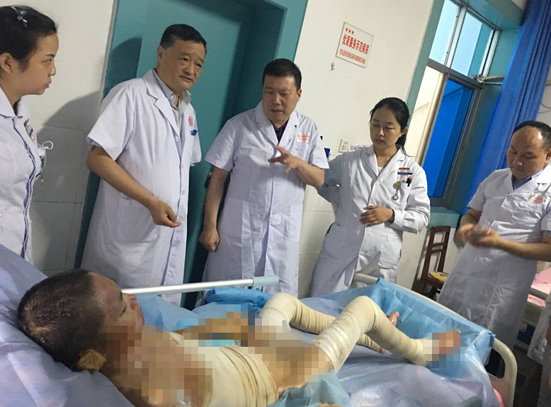 菲彩国际集团_郫都区人民医院运用烧伤创疡再生医疗手艺 让大面积烧伤少年获得新生