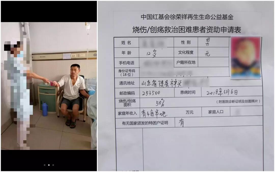 菲彩国际集团_父亲聋哑母亲智障 脑瘫儿童烫伤引发“爱心潮”