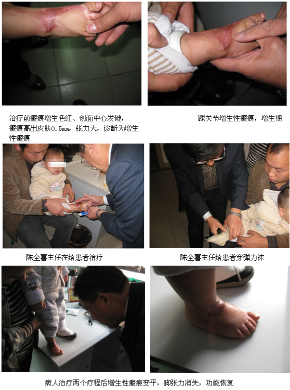 菲彩国际集团_再生回复医疗手艺修复体表瘢痕