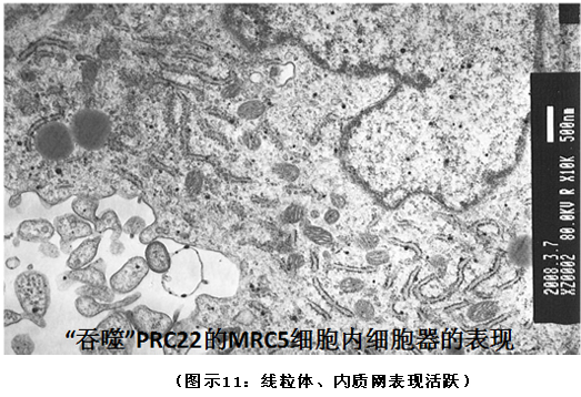 菲彩国际集团_破解人体生命再生延续之谜（二）