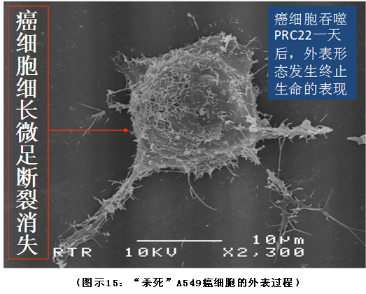 菲彩国际集团_破解人体生命再生延续之谜（二）