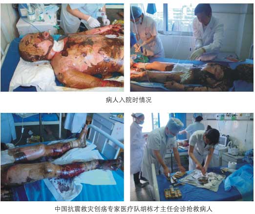 菲彩国际集团_一、创伤类再生回复