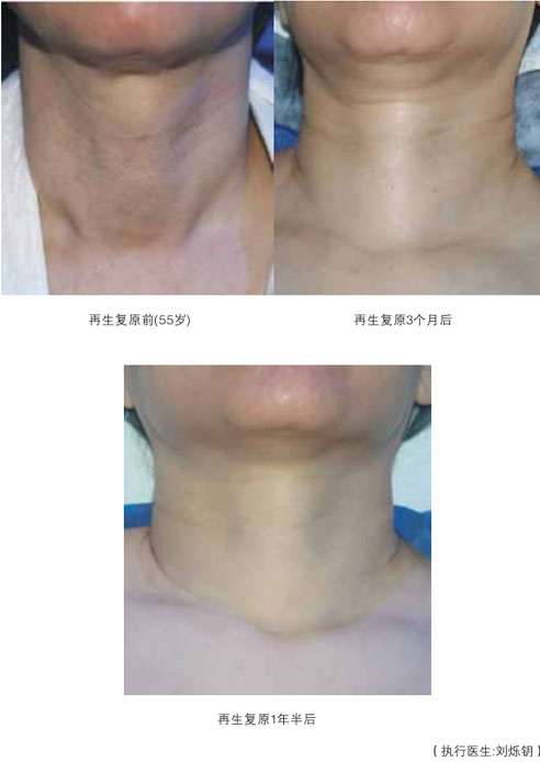 菲彩国际集团_五、朽迈皮肤的年轻再生回复