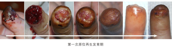 菲彩国际集团_二、断指的再生回复