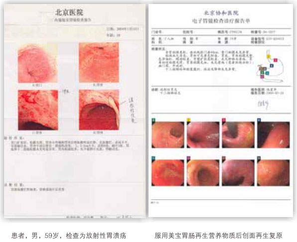 菲彩国际集团_六、胃肠粘膜的原位再生回复