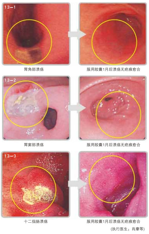 菲彩国际集团_六、胃肠粘膜的原位再生回复