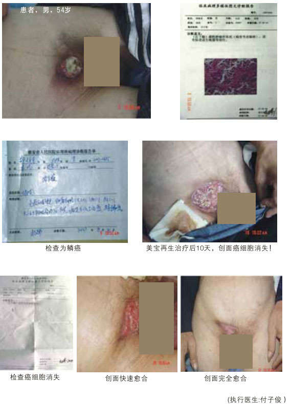 菲彩国际集团_八、再生抗癌的研究