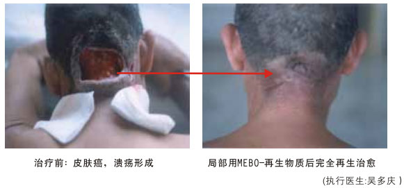 菲彩国际集团_八、再生抗癌的研究