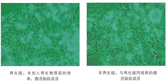 菲彩国际集团_八、再生抗癌的研究