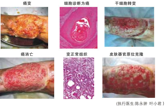 菲彩国际集团_八、再生抗癌的研究