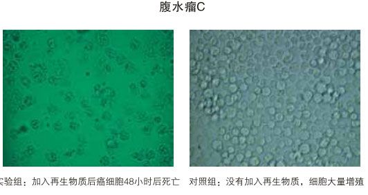 菲彩国际集团_八、再生抗癌的研究