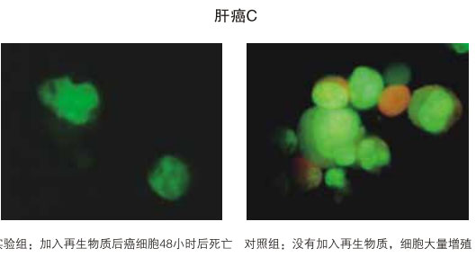 菲彩国际集团_八、再生抗癌的研究