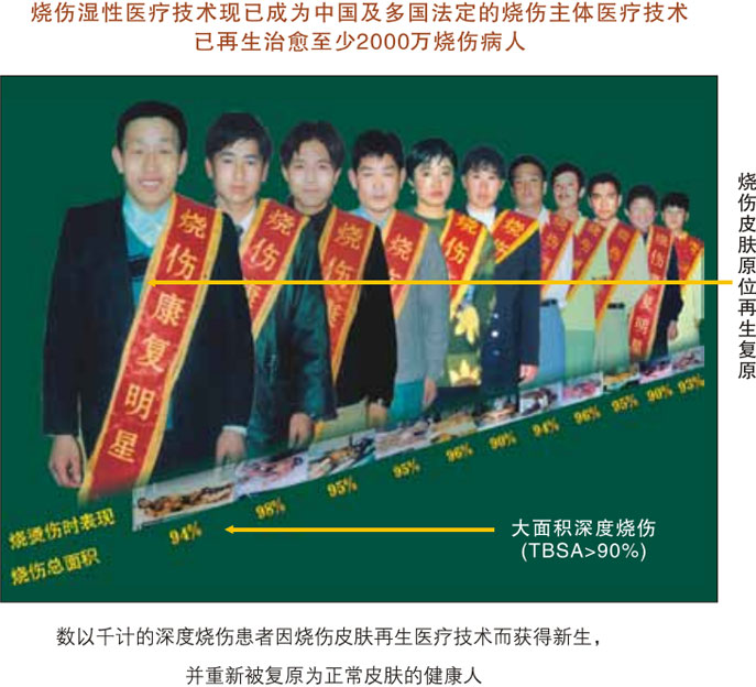 菲彩国际集团_一、原始组织学发明期（1987-1990年）