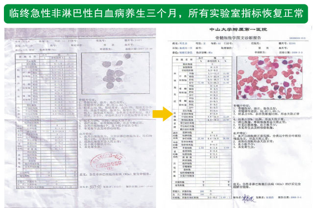 菲彩国际集团_七、癌症的神秘以及癌症与再生物质的关系