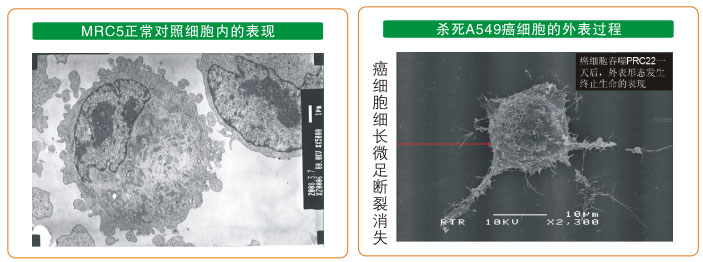 菲彩国际集团_七、癌症的神秘以及癌症与再生物质的关系