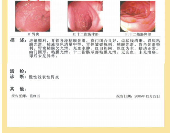 菲彩国际集团_七、临床验证