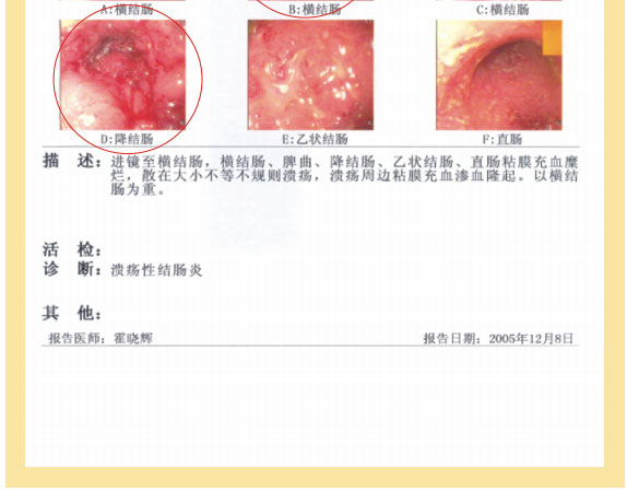 菲彩国际集团_七、临床验证