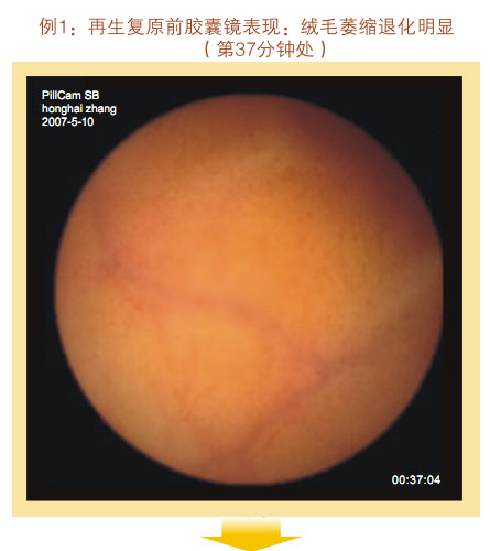 菲彩国际集团_七、临床验证