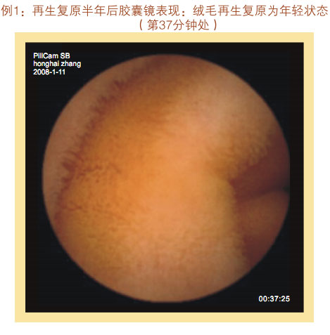 菲彩国际集团_七、临床验证