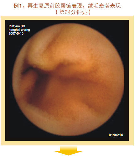 菲彩国际集团_七、临床验证