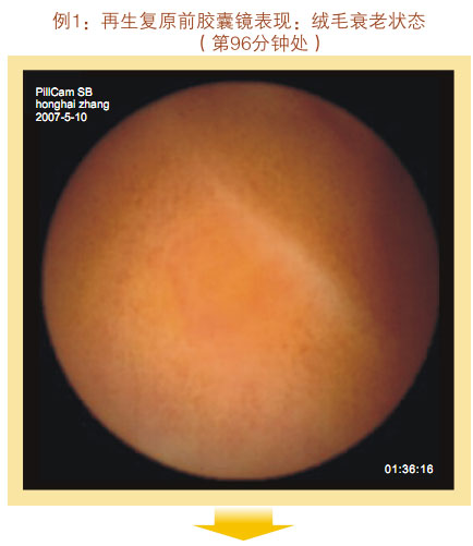 菲彩国际集团_七、临床验证