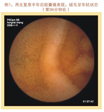 菲彩国际集团_七、临床验证