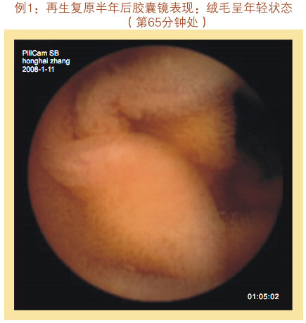 菲彩国际集团_七、临床验证