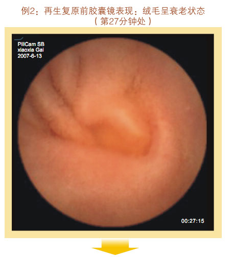 菲彩国际集团_七、临床验证