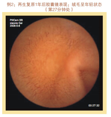 菲彩国际集团_七、临床验证