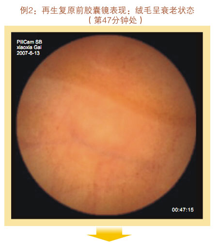 菲彩国际集团_七、临床验证