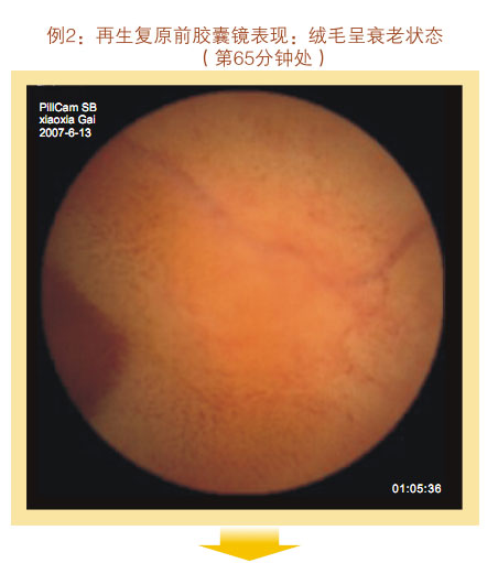 菲彩国际集团_七、临床验证