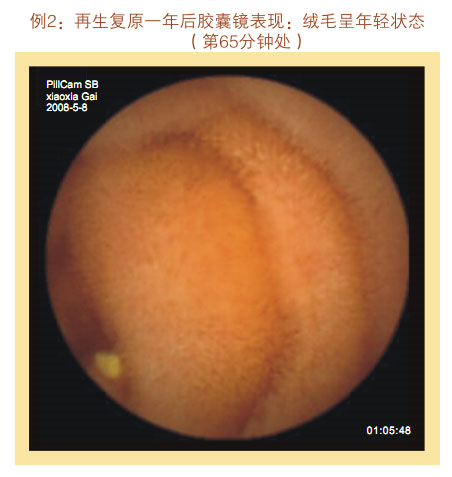 菲彩国际集团_七、临床验证