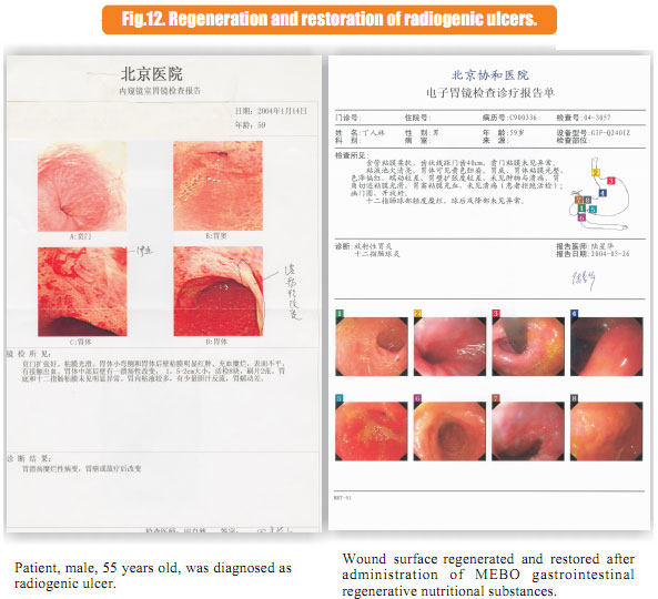 菲彩国际集团_6  In situ regenerative restoration of gastrointestinal muco