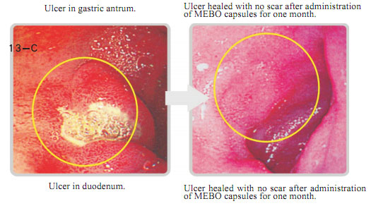 菲彩国际集团_6  In situ regenerative restoration of gastrointestinal muco