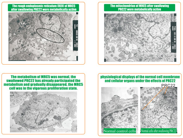 菲彩国际集团_8  Research on rResearch on regenerative anti-cancer