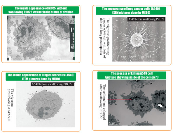 菲彩国际集团_8  Research on rResearch on regenerative anti-cancer