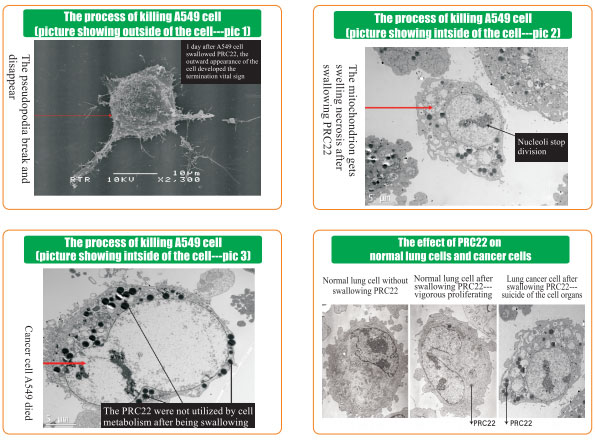 菲彩国际集团_8  Research on rResearch on regenerative anti-cancer