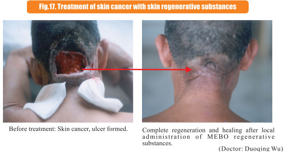 菲彩国际集团_8  Research on rResearch on regenerative anti-cancer