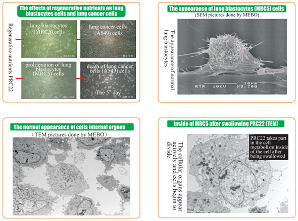 菲彩国际集团_8  Research on rResearch on regenerative anti-cancer