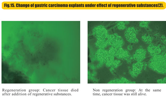 菲彩国际集团_8  Research on rResearch on regenerative anti-cancer