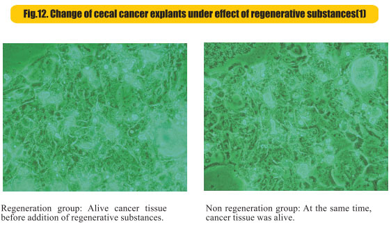 菲彩国际集团_8  Research on rResearch on regenerative anti-cancer