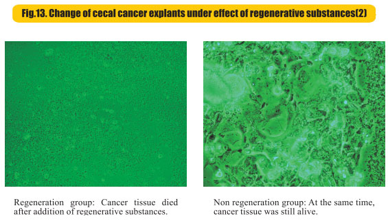 菲彩国际集团_8  Research on rResearch on regenerative anti-cancer