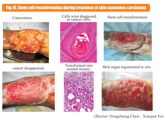 菲彩国际集团_8  Research on rResearch on regenerative anti-cancer
