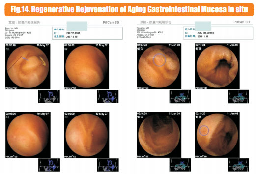 菲彩国际集团_6  In situ regenerative restoration of gastrointestinal muco