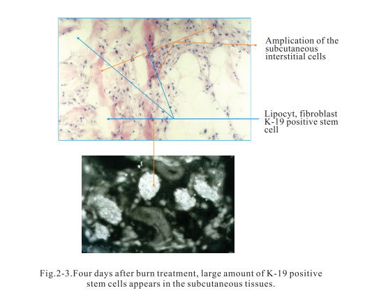 菲彩国际集团_2. Period of deciphering the secret of somatic cells being i
