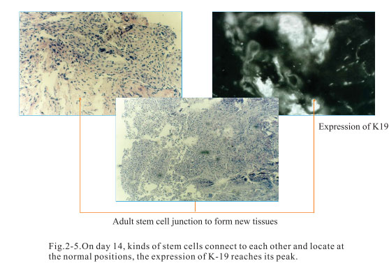 菲彩国际集团_2. Period of deciphering the secret of somatic cells being i