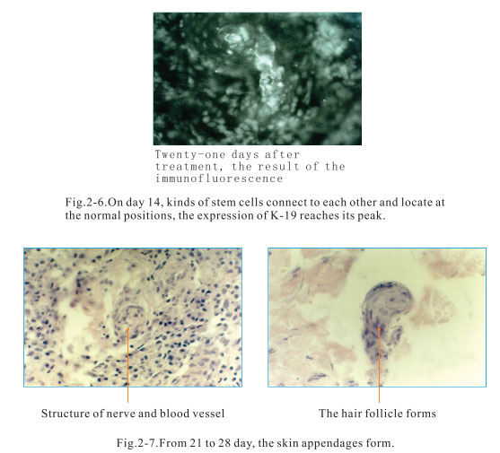 菲彩国际集团_2. Period of deciphering the secret of somatic cells being i