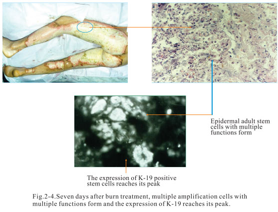 菲彩国际集团_2. Period of deciphering the secret of somatic cells being i