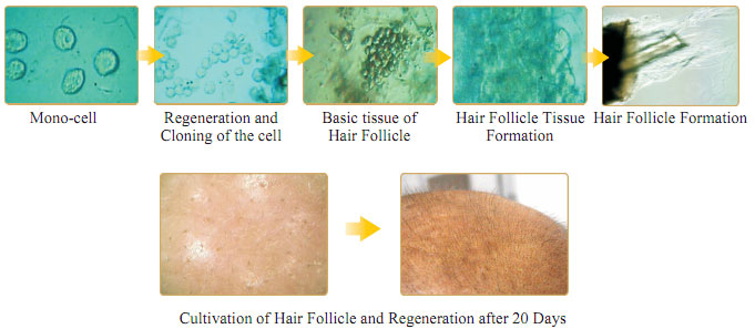 菲彩国际集团_Part One: In situ Skin Regenerative Restoration & Rejuvenati