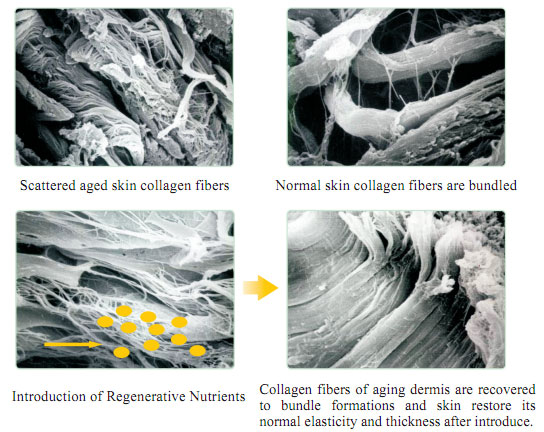 菲彩国际集团_Part One: In situ Skin Regenerative Restoration & Rejuvenati
